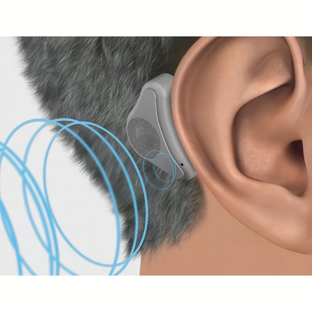 Система костной проводимости ADHEAR - Изображение 3 из 5